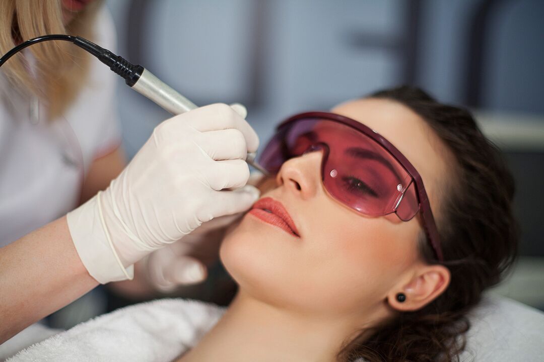 lasertoforese para rejuvenescimento da pele