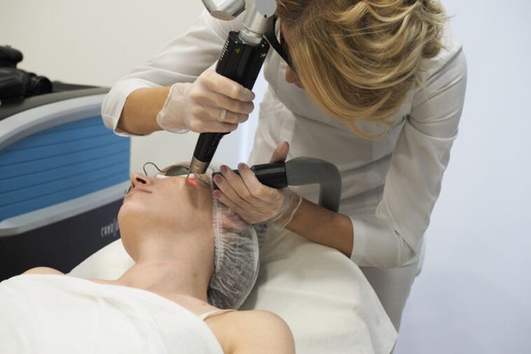 procedimento de rejuvenescimento da pele a laser