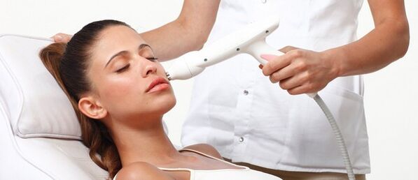 Procedimento de rejuvenescimento a laser