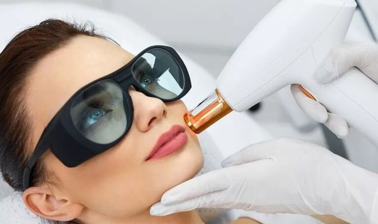Rejuvenescimento a laser da pele