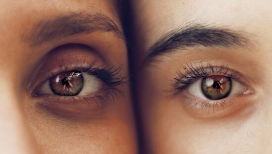 Círculos escuros sob os olhos