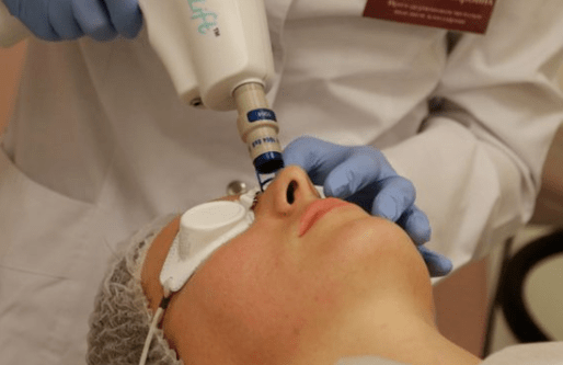 Rejuvenescimento a laser não capaz