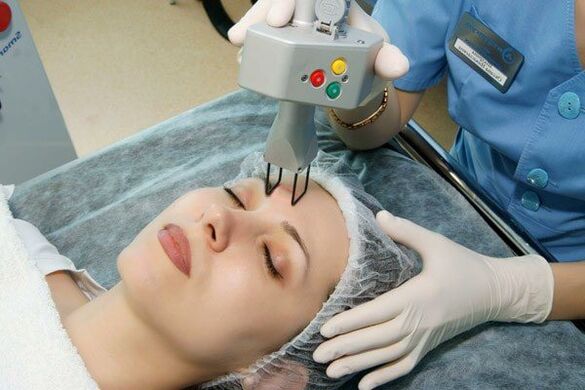 Rejuvenescimento a laser