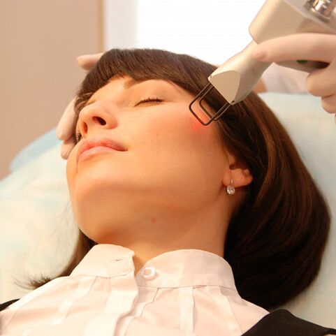 Tipos de lasers