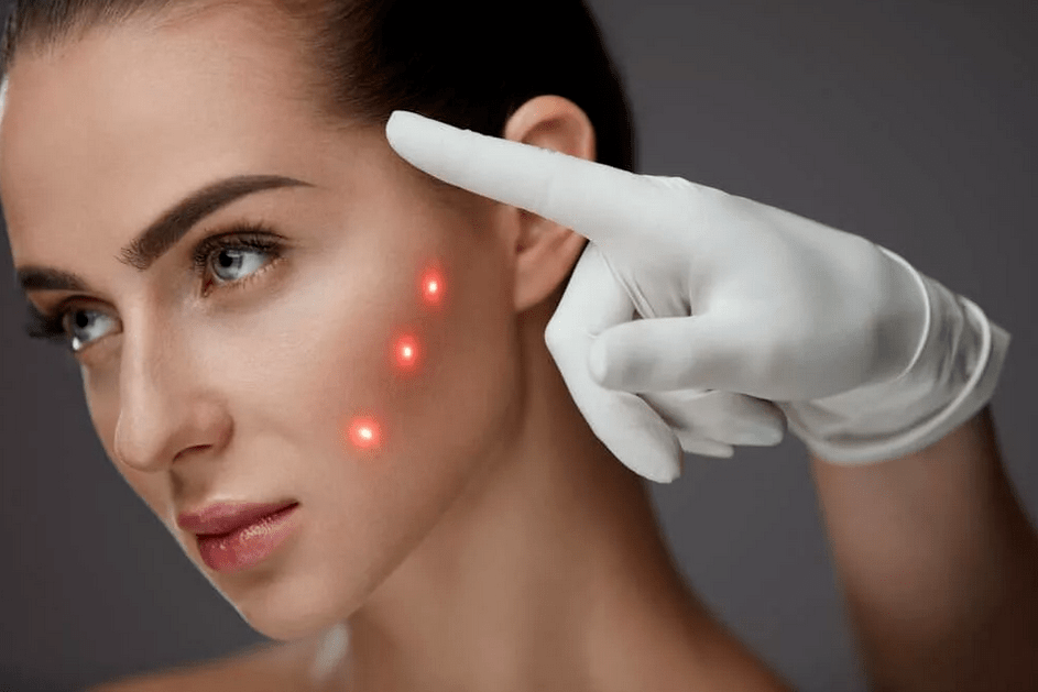 métodos de rejuvenescimento