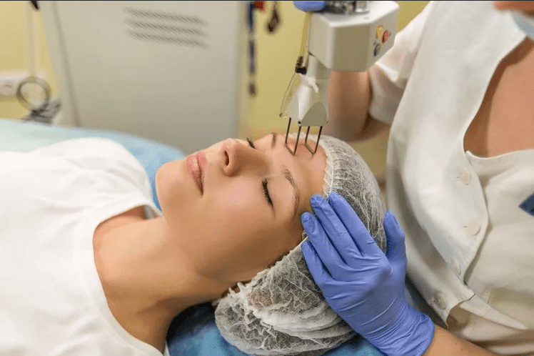 processo de rejuvenescimento facial a laser