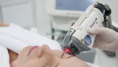 Como é realizado o rejuvenescimento fracionado da pele